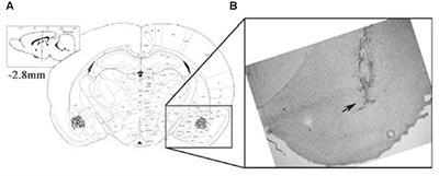 Regulation of Fear Extinction in the Basolateral Amygdala by Dopamine D2 Receptors Accompanied by Altered GluR1, GluR1-Ser845 and NR2B Levels